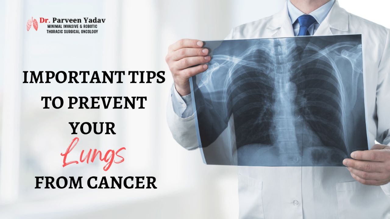 Important Tips To Prevent Your Lungs From Cancer.