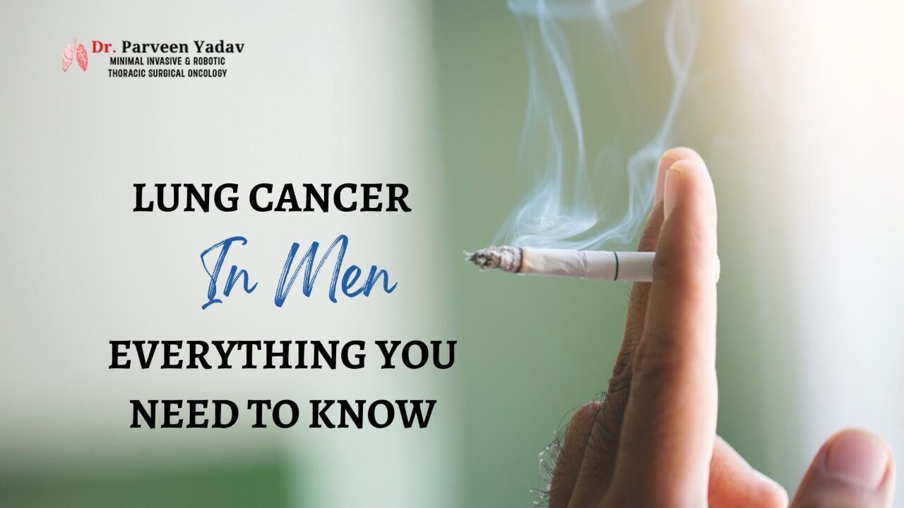 Lung Cancer In Men: Everything You Need To Know