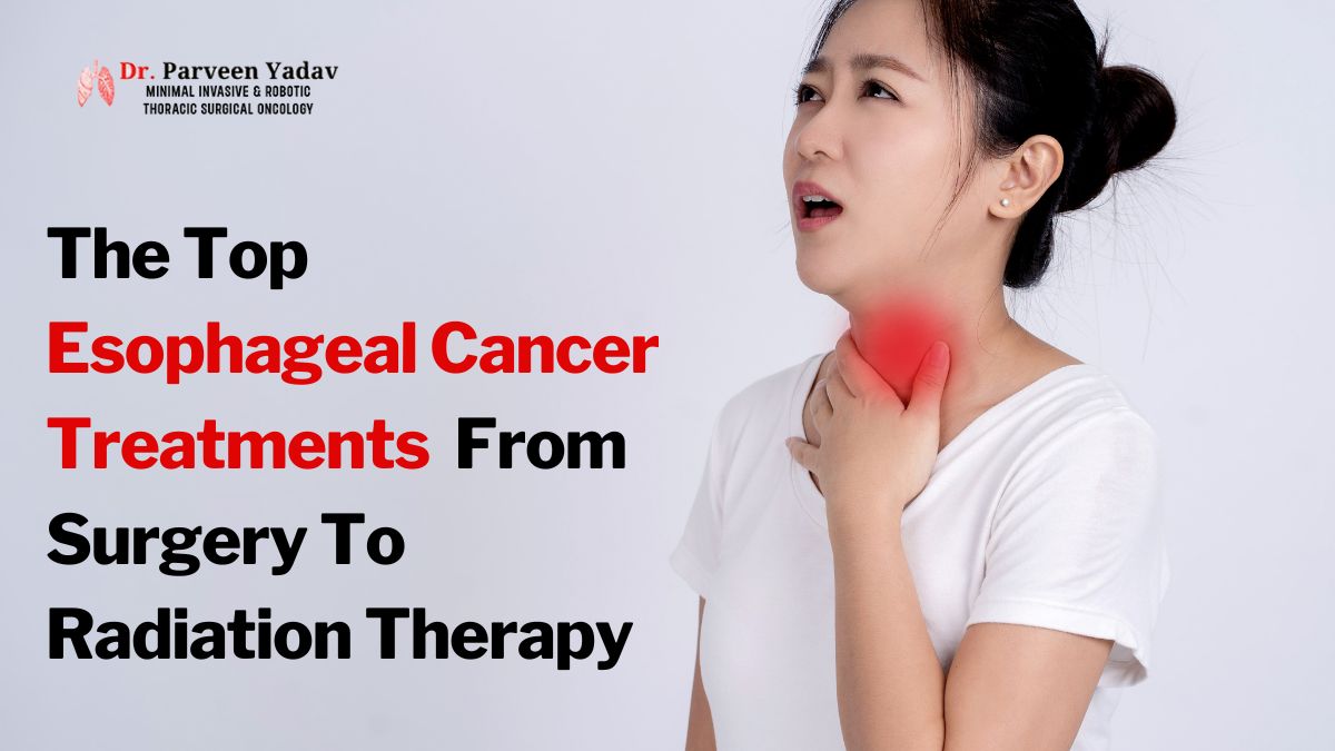 The Top Esophageal Cancer Treatments – From Surgery To Radiation Therapy