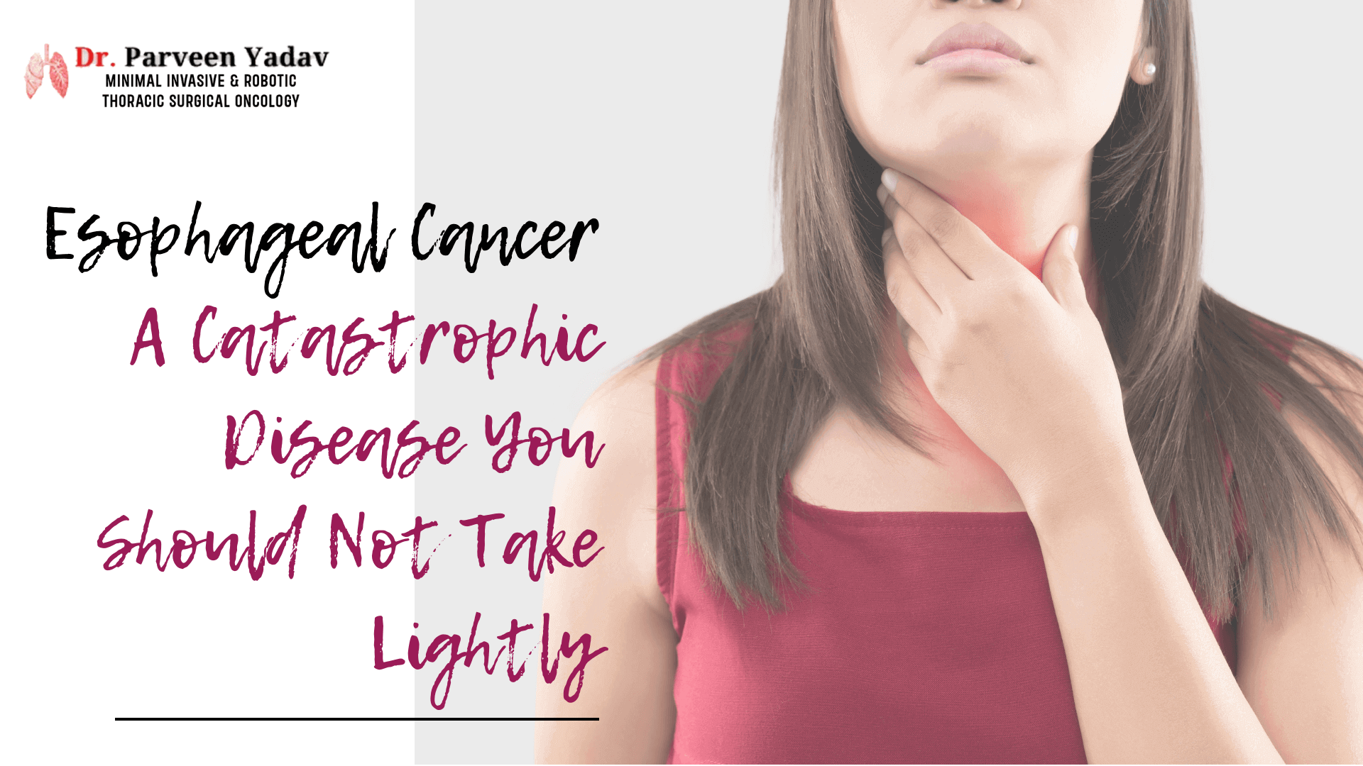 Esophageal Cancer: A Catastrophic Disease You Should Not Take Lightly