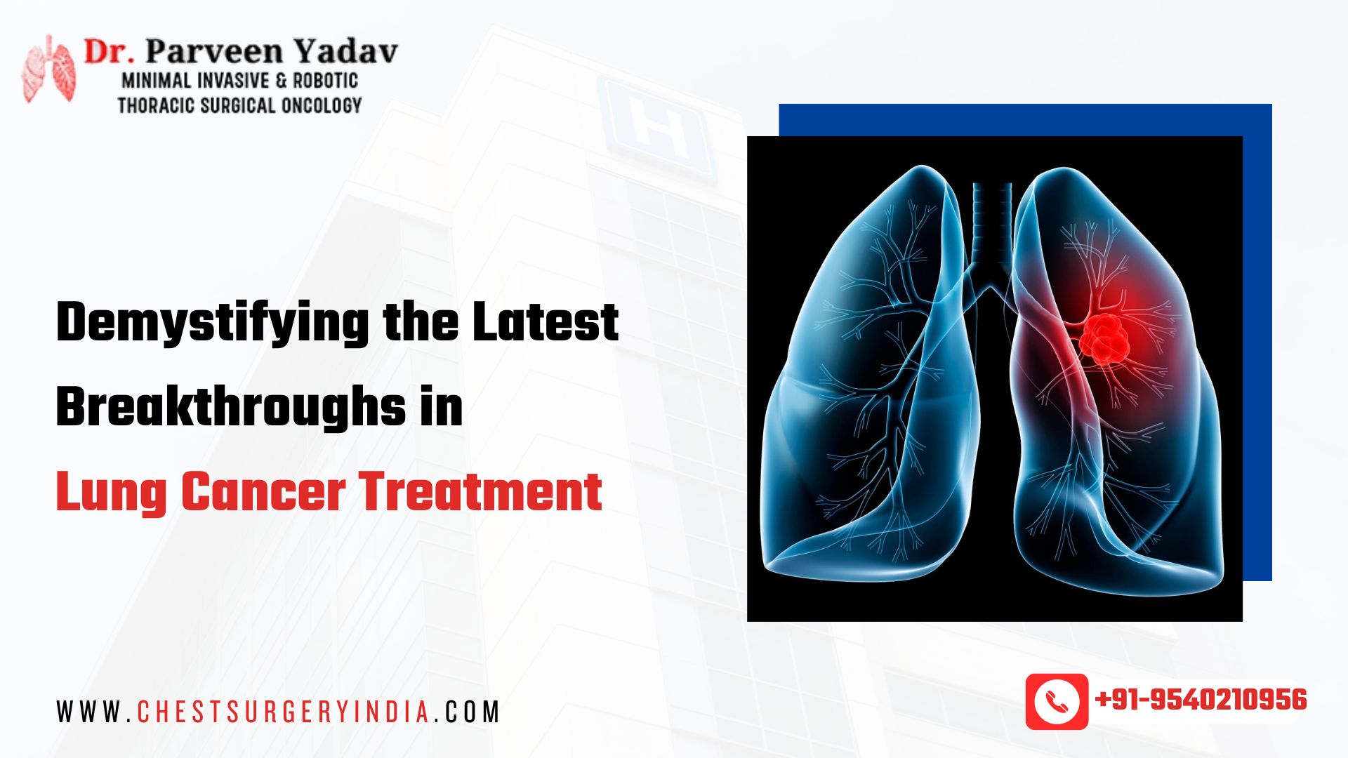 Demystifying Latest Breakthroughs in Lung Cancer Treatment | Innovations & Advances