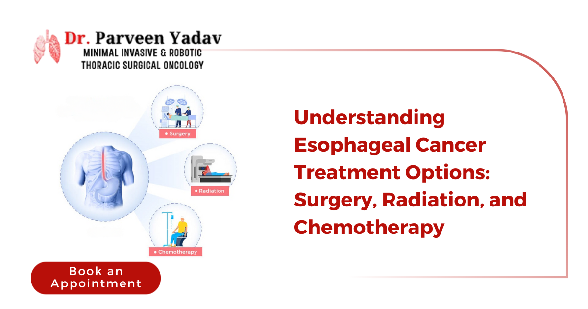 Understanding Esophageal Cancer Treatment Options: Surgery, Radiation, and Chemotherapy