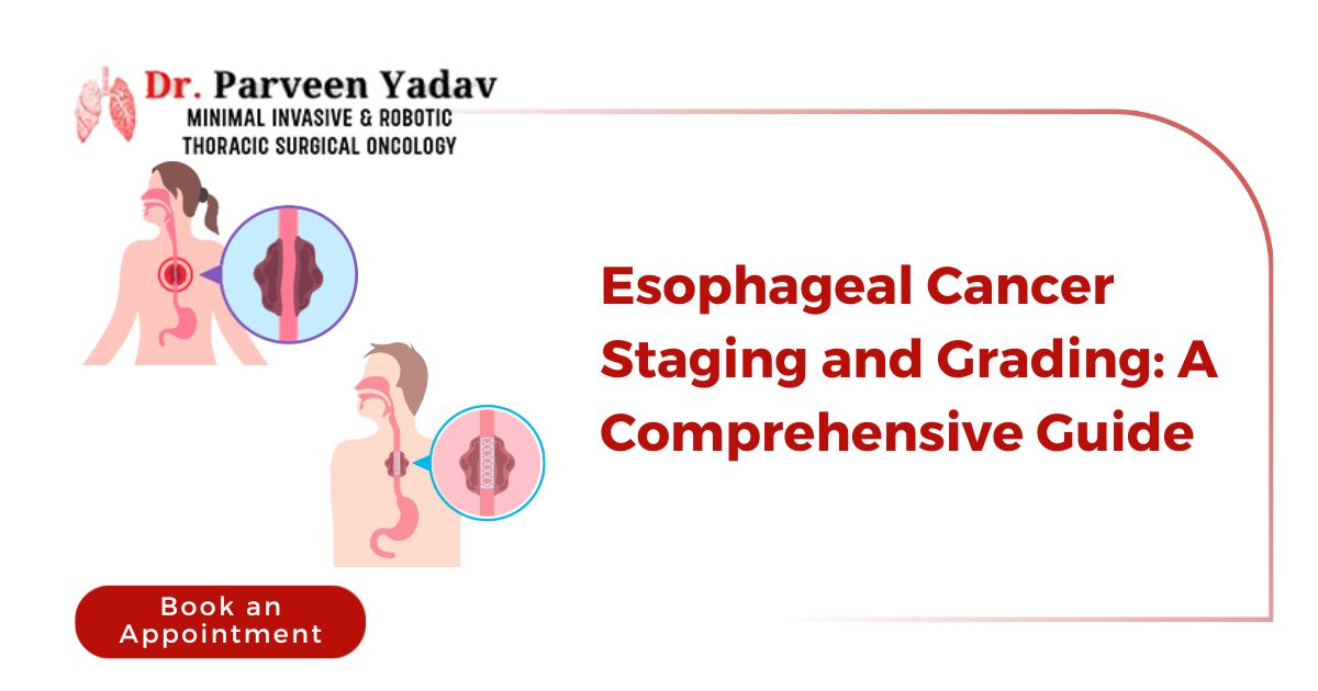Esophageal Cancer Staging and Grading: A Comprehensive Guide
