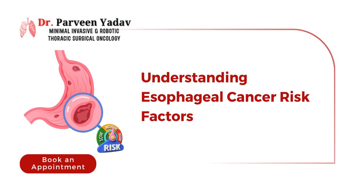 Understanding Esophageal Cancer Risk Factors