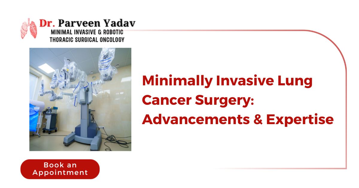 Minimally Invasive Lung Cancer Surgery: Advancements & Expertise