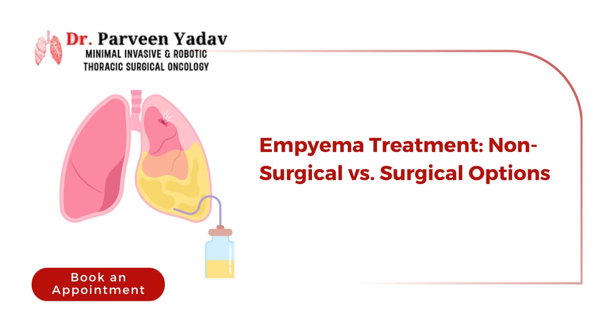 Empyema Treatment: Non-Surgical vs. Surgical Options