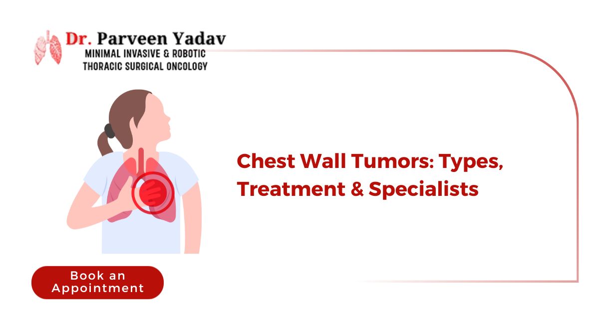Chest Wall Tumors: Types, Treatment & Specialists