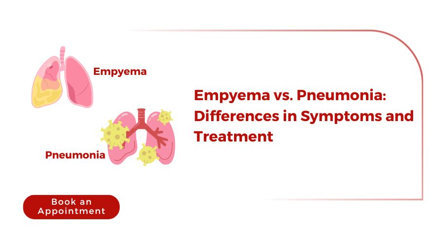 Empyema vs Pneumonia: Differences in Symptoms and Treatment