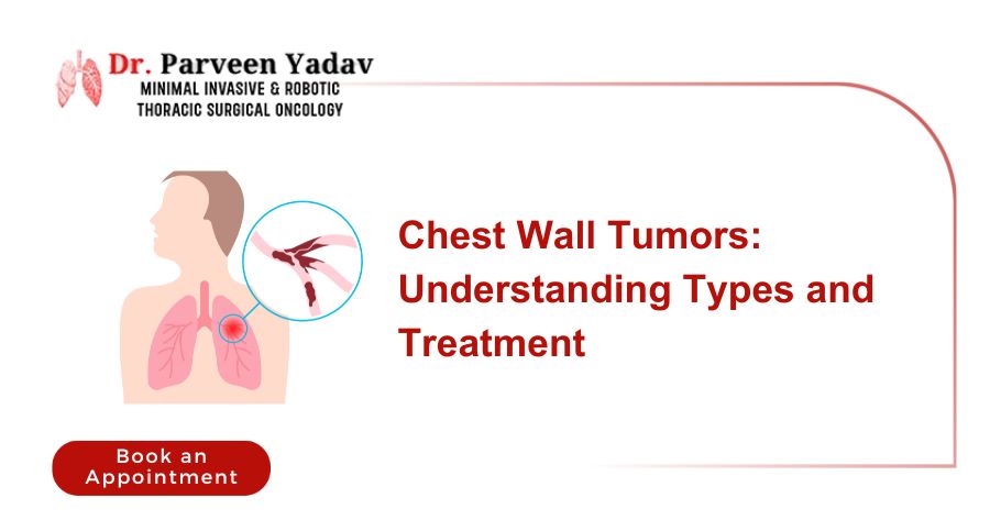 The Types of Chest Wall Tumors Everyone Should Know