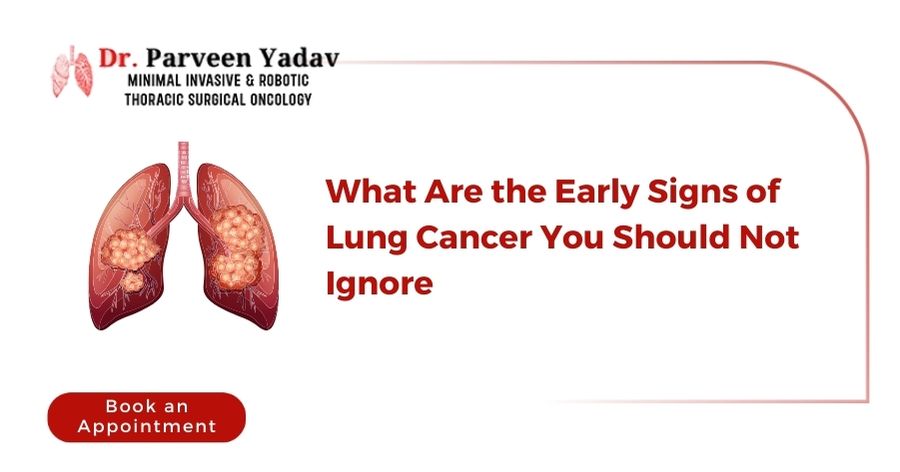 What Are the Early Signs of Lung Cancer You Should Not Ignore