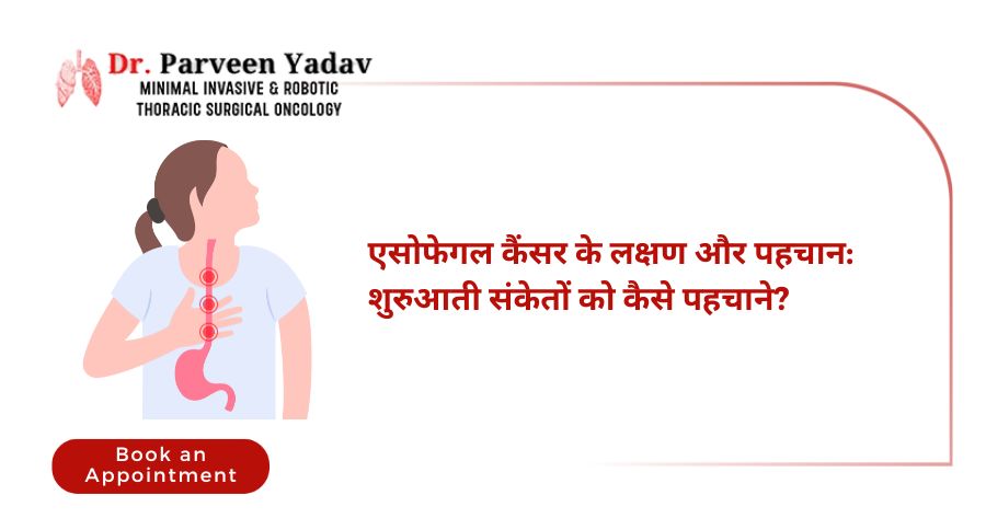 एसोफेगल कैंसर के लक्षण और पहचान: शुरुआती संकेतों को कैसे पहचाने?