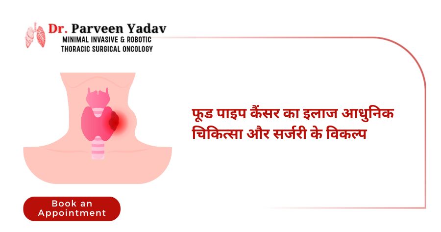 फूड पाइप कैंसर का इलाज आधुनिक चिकित्सा और सर्जरी के विकल्प