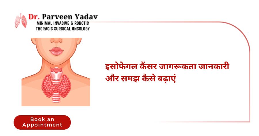 इसोफेगल कैंसर जागरूकता जानकारी और समझ कैसे बढ़ाएं