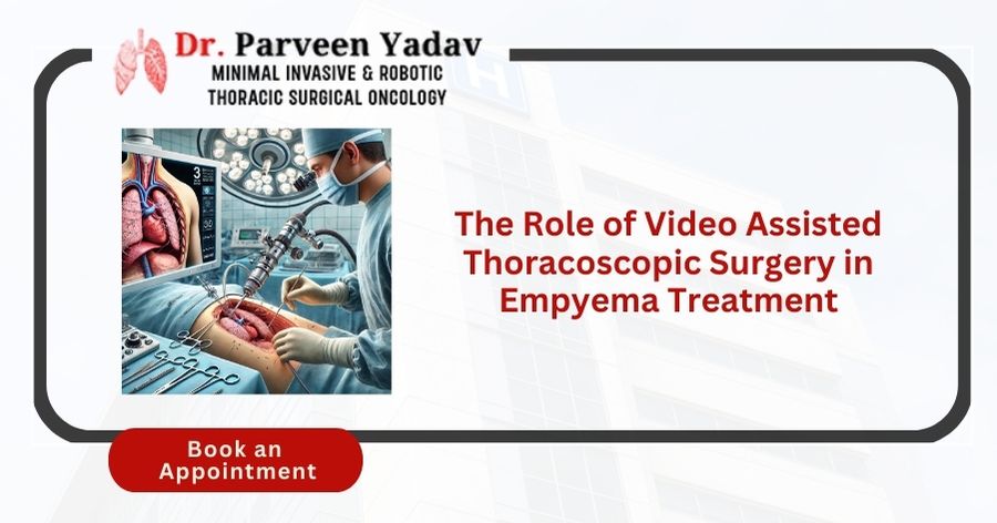 The Role of Video Assisted Thoracoscopic Surgery in Empyema Treatment