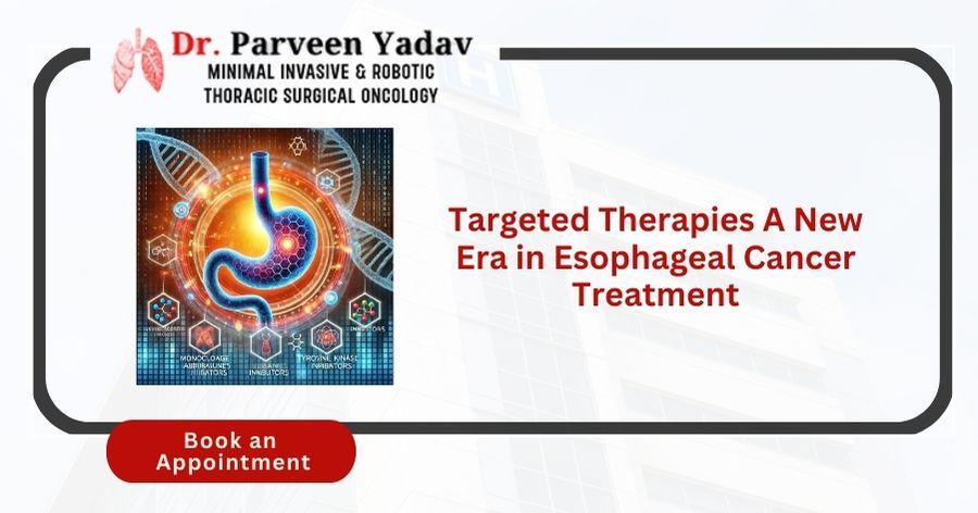 Targeted Therapies A New Era in Esophageal Cancer Treatment