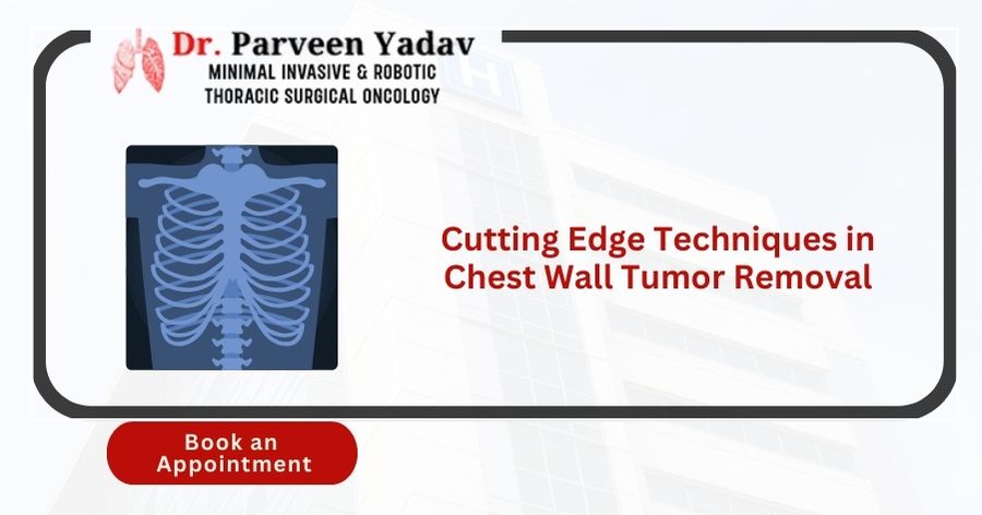 Cutting Edge Techniques in Chest Wall Tumor Removal