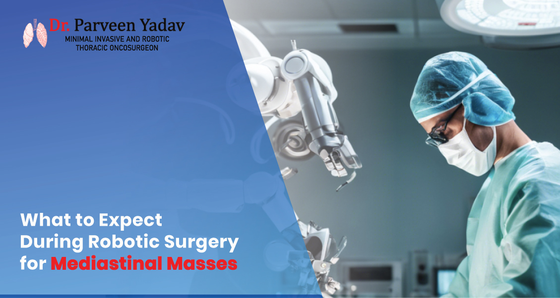 What to Expect During Robotic Surgery for Mediastinal Masses