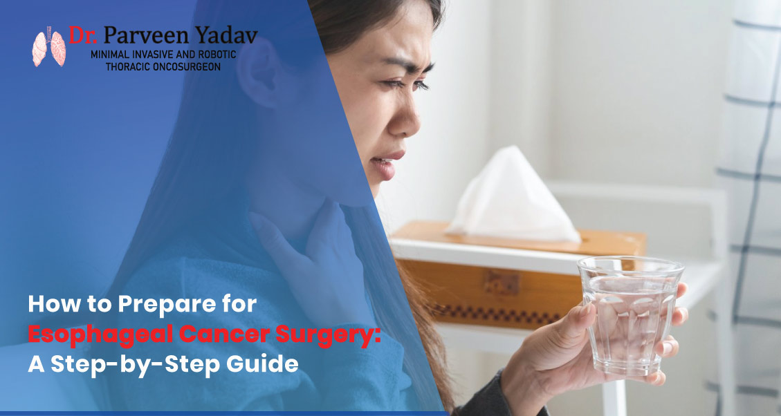How to Prepare for Esophageal Cancer Surgery: A Step-by-Step Guide