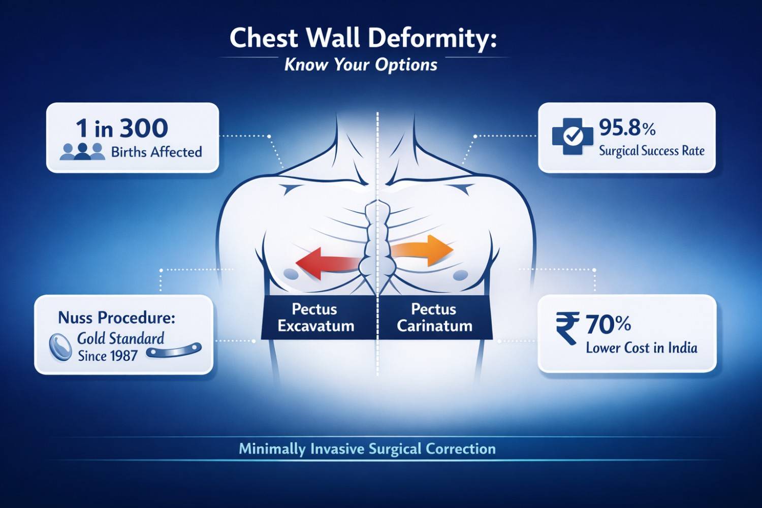 Pectus Excavatum & Carinatum: Chest Wall Surgery in India