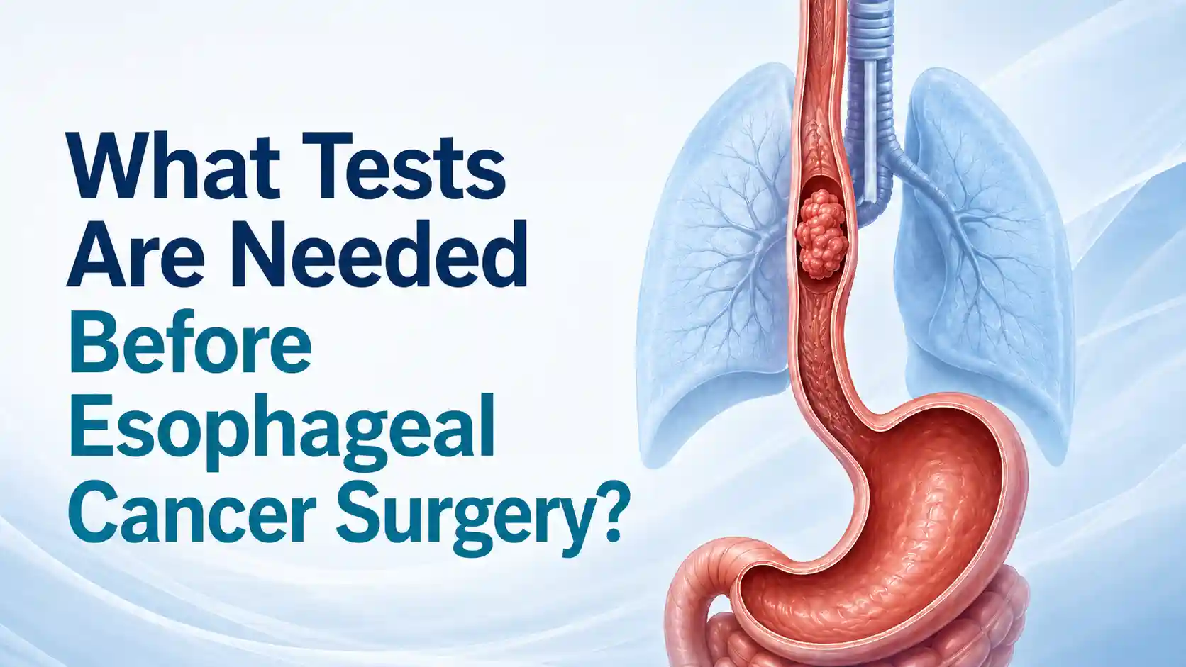 What Tests Are Needed Before Esophageal Cancer Surgery?