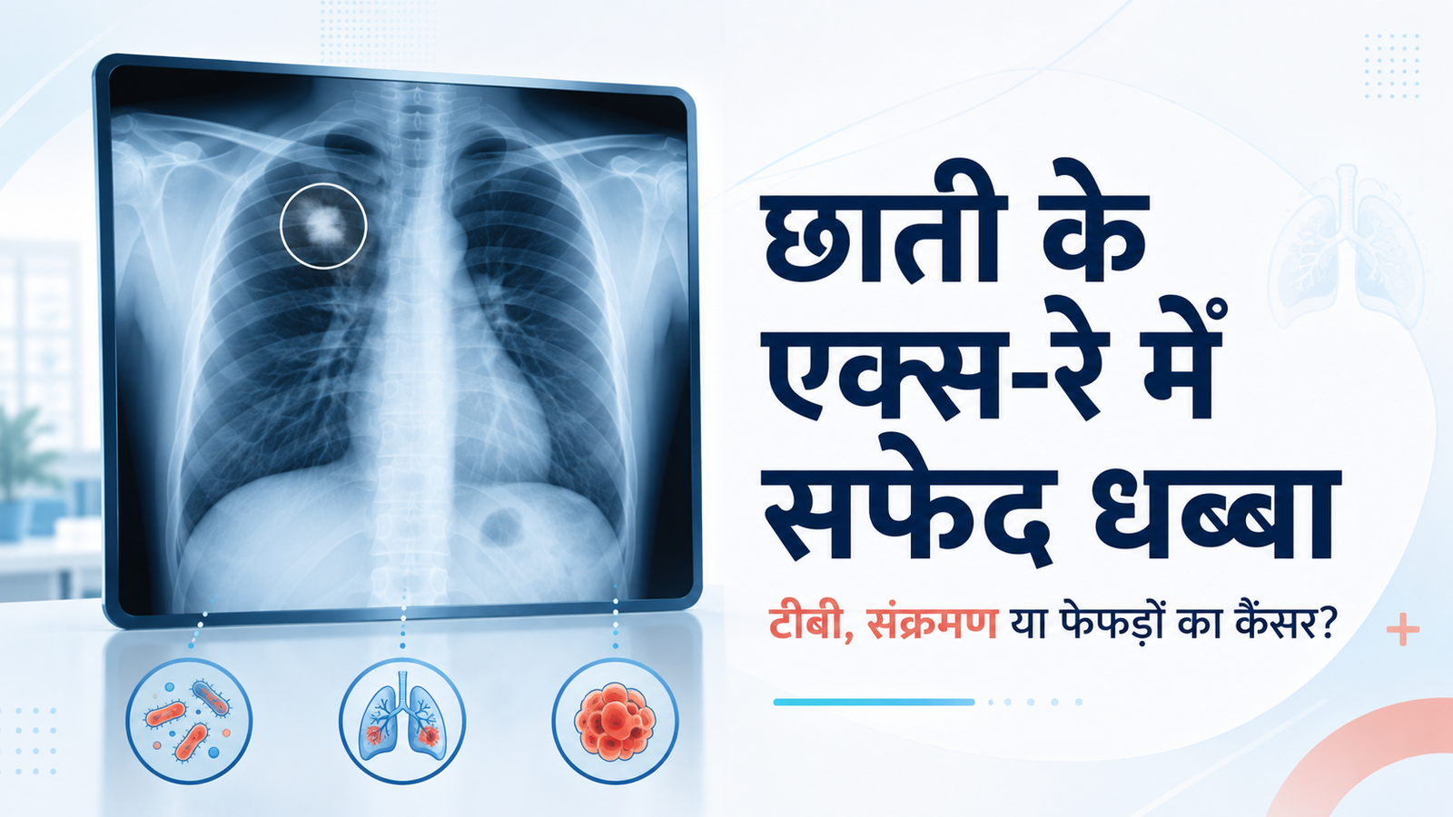 छाती के X-Ray में सफेद धब्बा दिखे तो क्या करें?