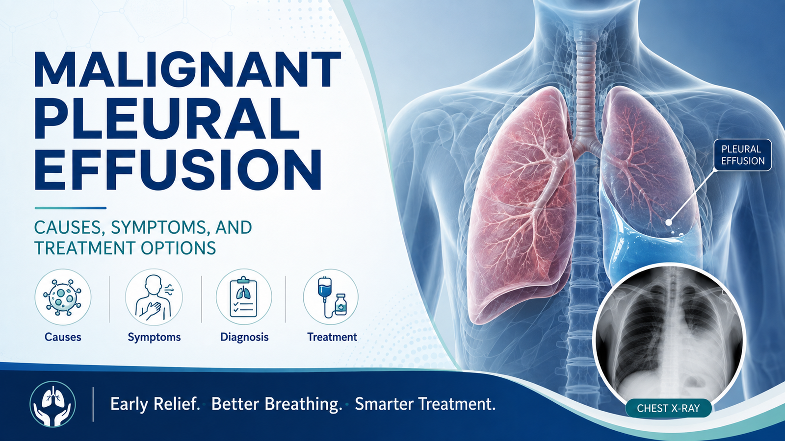 Malignant Pleural Effusion: Causes, Symptoms, and Treatment Options